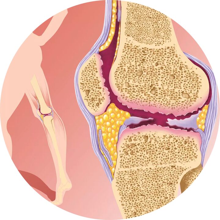 Hondroten apoya la movilidad de las articulaciones